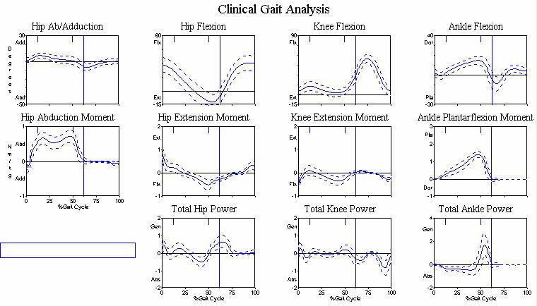 Gait Motion Analysis 97